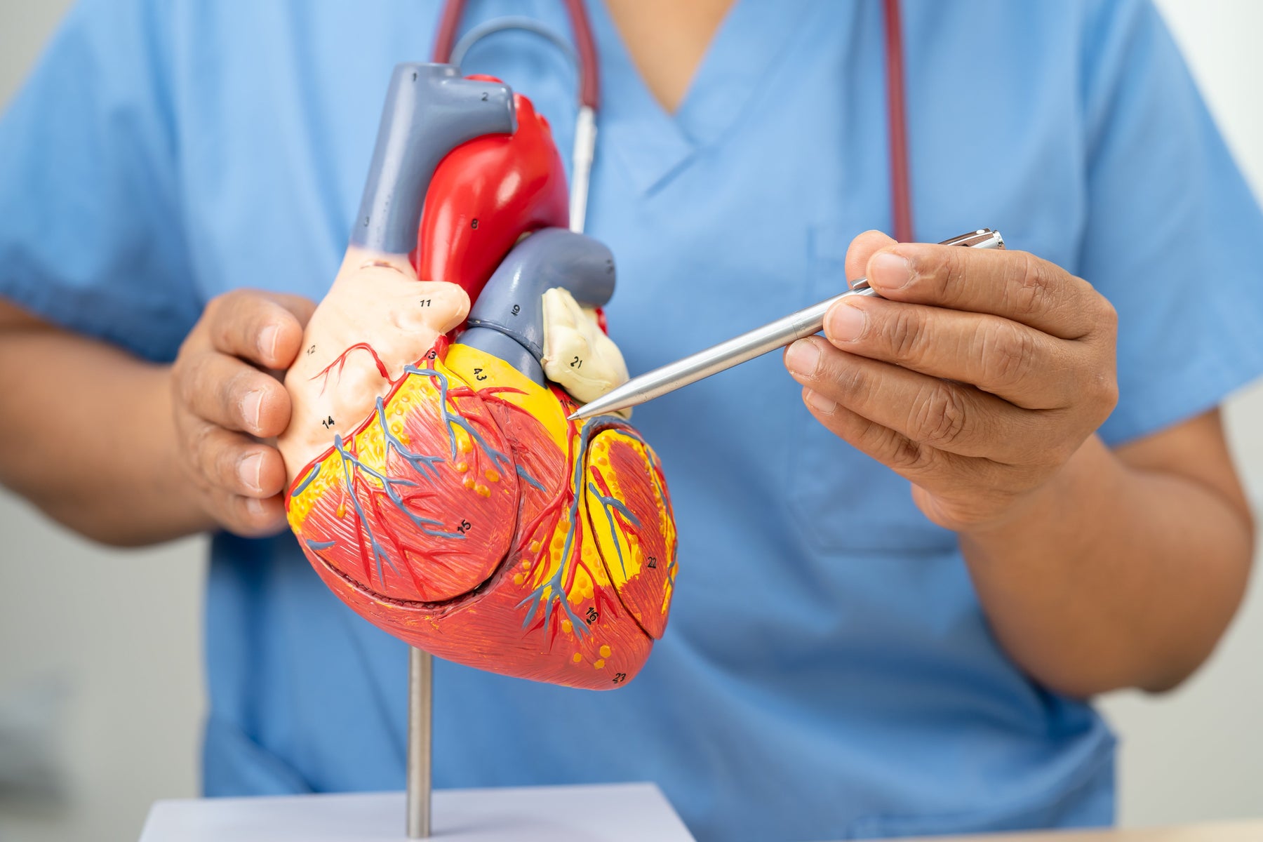 Coronary artery bypass grafting (CABG)