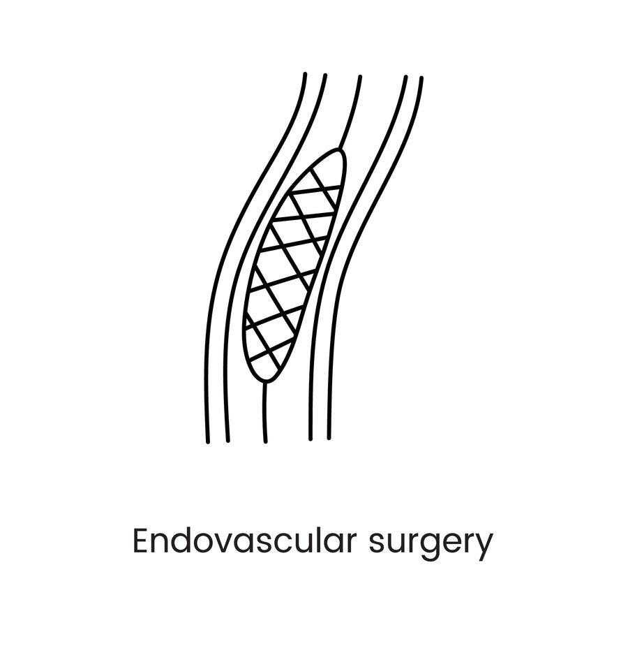 Endovascular Surgery: What Patients Really Experience Before and After Treatment