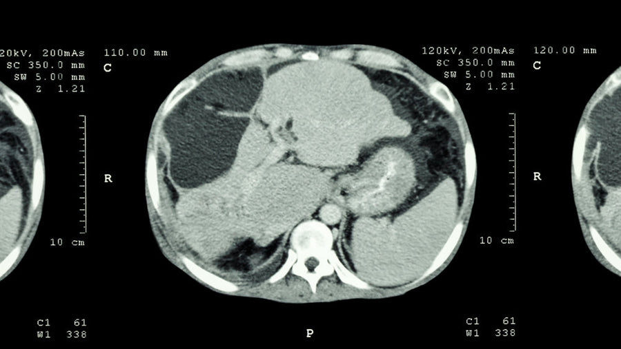 Hepatobiliary Surgery