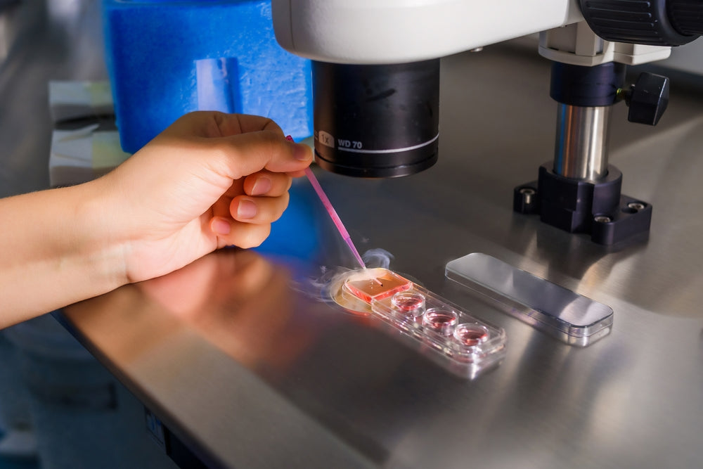IVF – In Vitro Fertilization