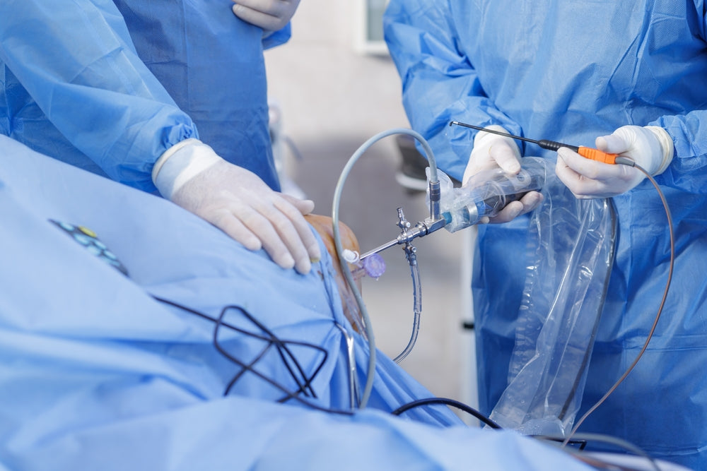 Reconstructive Orthopedic Surgery