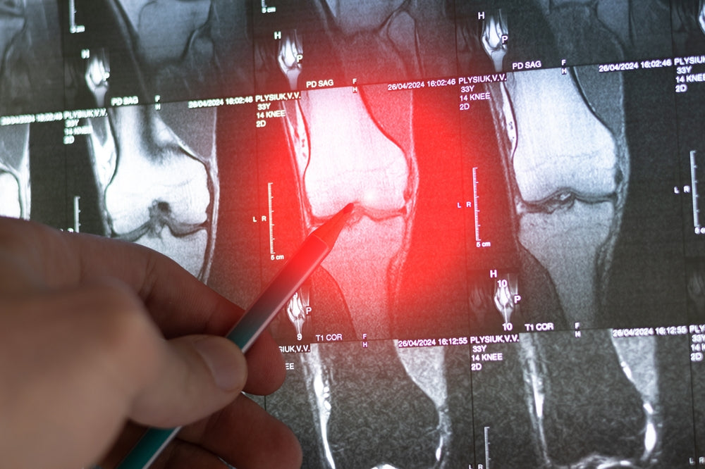 Orthopedics & Oncological Orthopedics